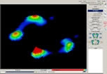 huella plantar por medico podologo