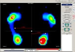 huella plantar por medico podologo