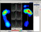 huella plantar por medico podologo