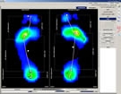 huella plantar por medico podologo